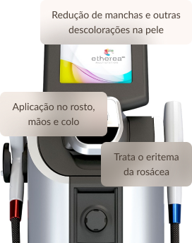 Luz Intensa Pulsada Redução De Manchas E Outras Descolorações Na Pele