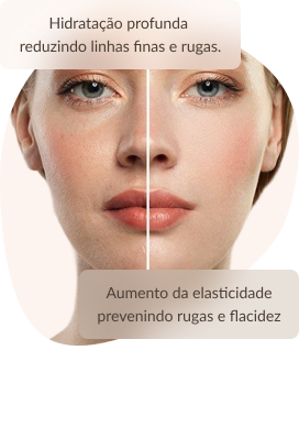 Procedimento Skinbooster Hidratação Profunda Reduzindo Linhas Finas E Rugas