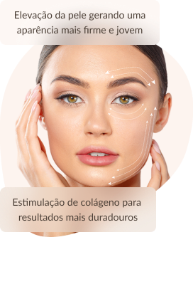 Fios De Pdo Elevação Da Pele Gerando Uma Aparência Mais Firme E Jovem