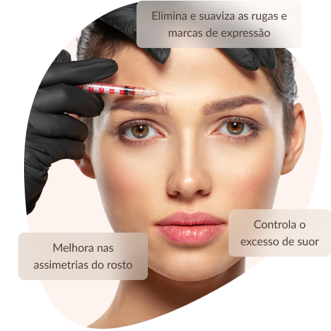 Botox no rosto melhora nas assimetrias do rosto