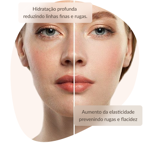 Procedimento Skinbooster