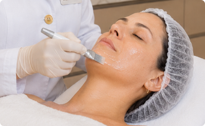 Peeling Facial feito pela Alciara Lima dermatologista