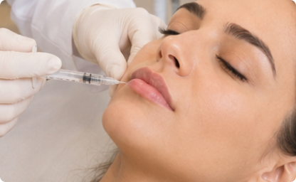 Preenchimento Labial feito pela Alciara Lima dermatologista