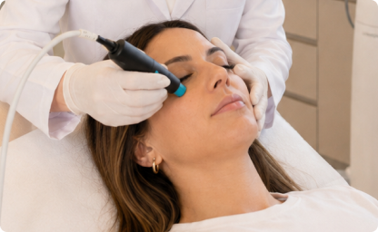 tratamento para olheiras feito pela dermatologista Alciara Lima