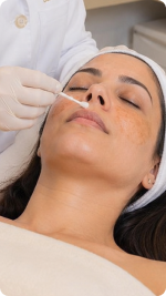 Alciara Lima Dermatologista fazendo tratamento de melasma em uma paciente
